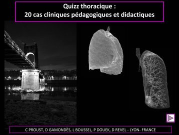 20 cas thorax c proust 2011 - RADIOLOGIE BRABOIS