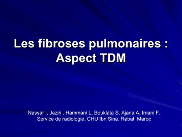 Les fibroses pulmonaires : Aspect TDM