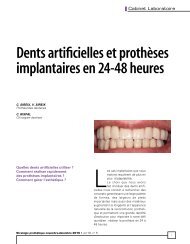 Dents artificielles et prothèses implantaires en 24-48 heures - Heraeus