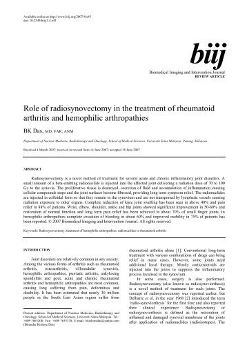 Role of radiosynovectomy in the treatment of rheumatoid arthritis ...