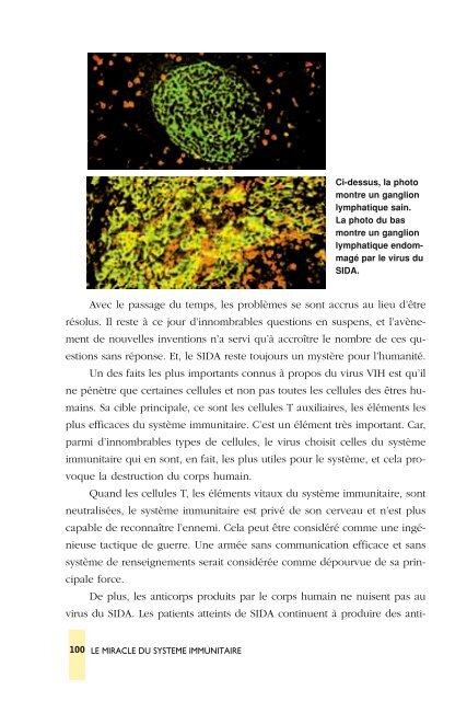 systeme_immunitaire