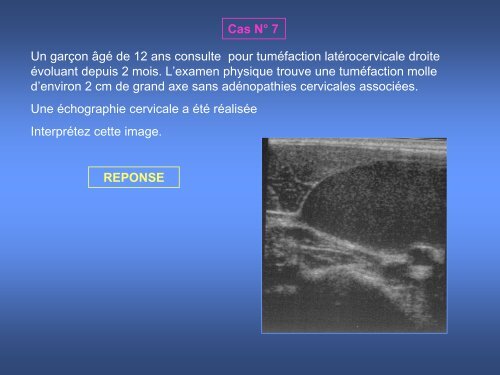 imagerie des masses kystiques cervicales de l'enfant - smorl