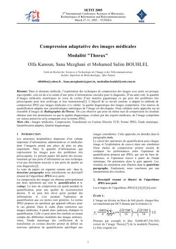 Compression adaptative des images médicales Modalité "Thorax"