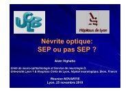 Névrites optiques : SEP ou pas SEP