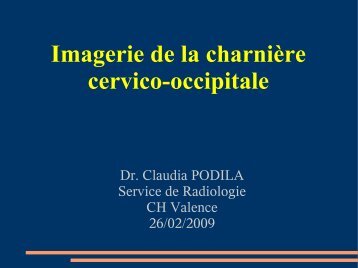 Imagerie de la charnière cervico-occipitale