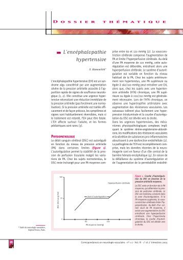 L encéphalopathie hypertensive - Accident vasculaire cérébral