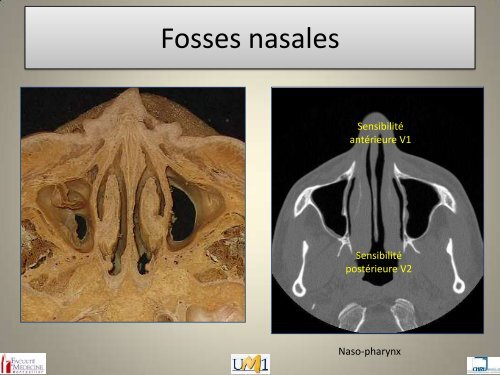 Anatomie topographique de la face et nerfs crâniens - Le Campus ...