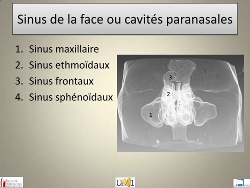 Anatomie topographique de la face et nerfs crâniens - Le Campus ...