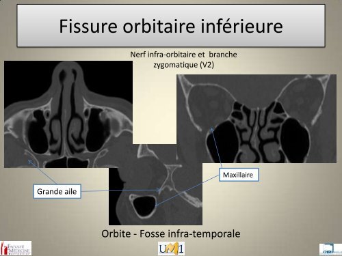 Anatomie topographique de la face et nerfs crâniens - Le Campus ...