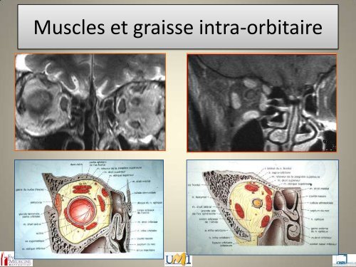 Anatomie topographique de la face et nerfs crâniens - Le Campus ...