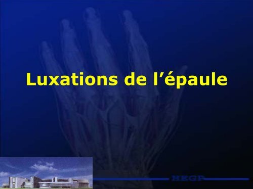 Luxations de l'épaule - RRMS