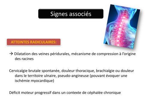 Cas clinique d'anesthésie obstétricale - ALR 13