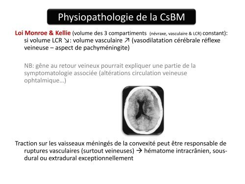 Cas clinique d'anesthésie obstétricale - ALR 13