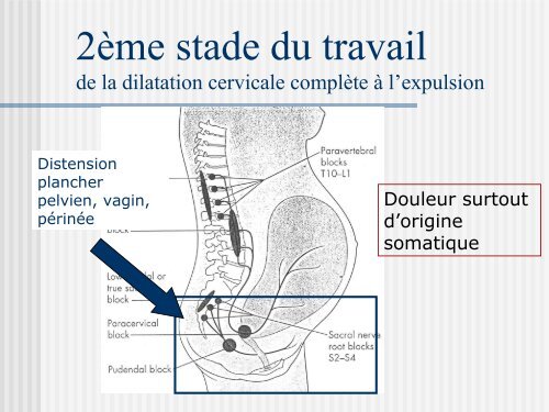 « Update » en Anesthésie-Analgésie Obstétricale - EIUA