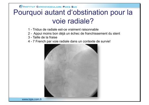 Télécharger la présentation - Mediathèque du congrès de High ...