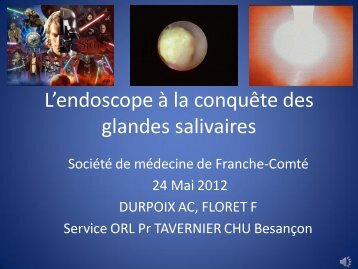 La sialendoscopie - (CHU) de Besançon