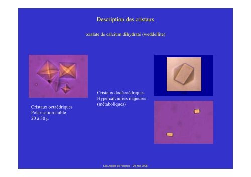 Caractéristiques biologiques et signification clinique - Les Jeudis de ...