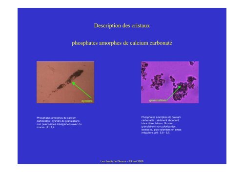 Caractéristiques biologiques et signification clinique - Les Jeudis de ...