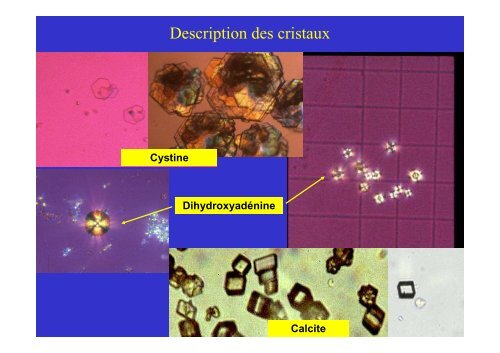 Caractéristiques biologiques et signification clinique - Les Jeudis de ...