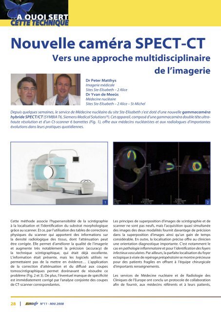 LA THYROÏDE - Europa Ziekenhuizen