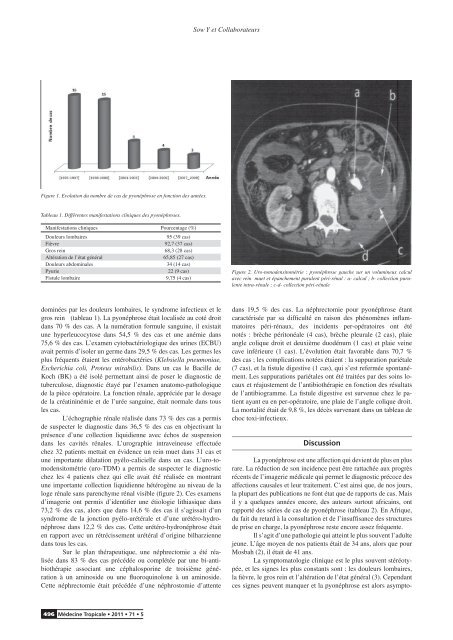 Article original Pyonéphrose : 44 observations au Sénégal