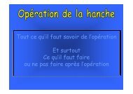 Que faire et ne pas faire juste après une prothèse de hanche.