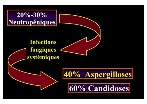 Prise en charge des aspergilloses - Infectio-lille.com