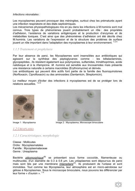 Comparaison de trois méthodes pour la détection de Mycoplasma et ...