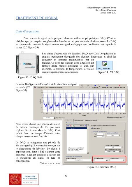 Surveillance Cardiaque - Thierry PERISSE