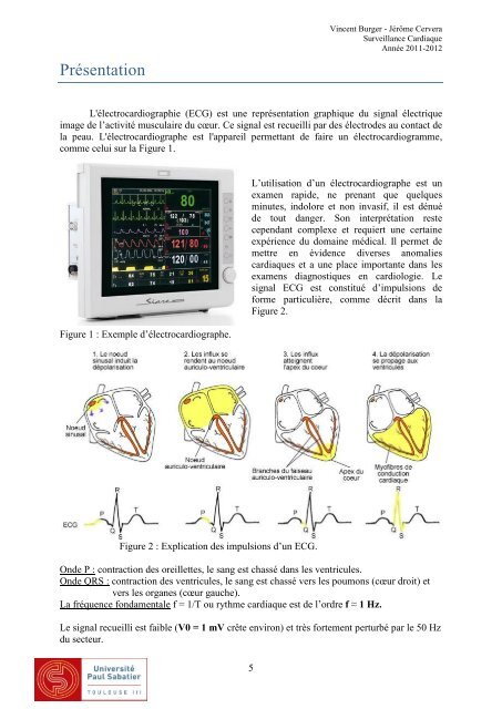 Surveillance Cardiaque - Thierry PERISSE