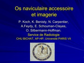 Os naviculaire accessoire et imagerie