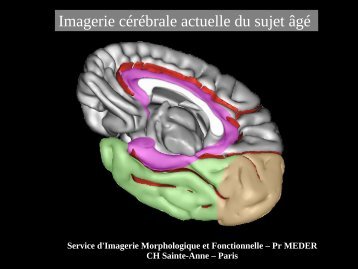 Imagerie cérébrale actuelle du sujet âgé (Dr. RODRIGO)