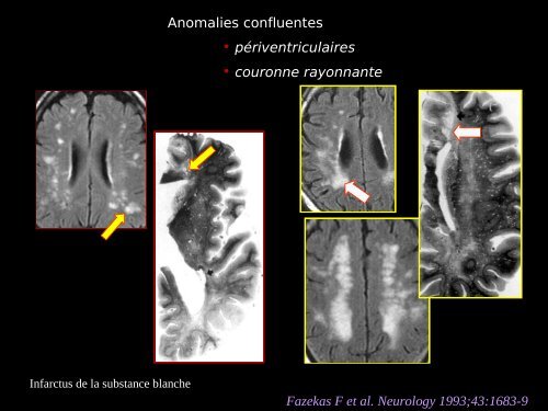 Imagerie cérébrale actuelle du sujet âgé (Dr. RODRIGO)