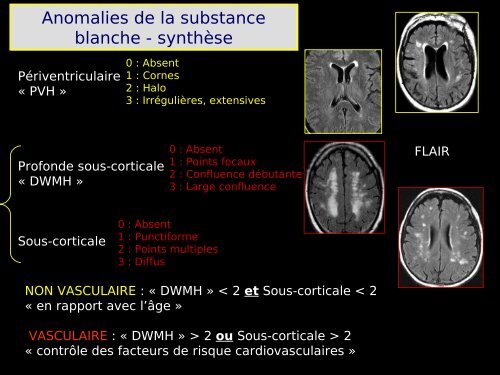 Imagerie cérébrale actuelle du sujet âgé (Dr. RODRIGO)