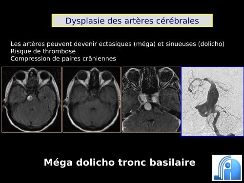 Imagerie cérébrale actuelle du sujet âgé (Dr. RODRIGO)