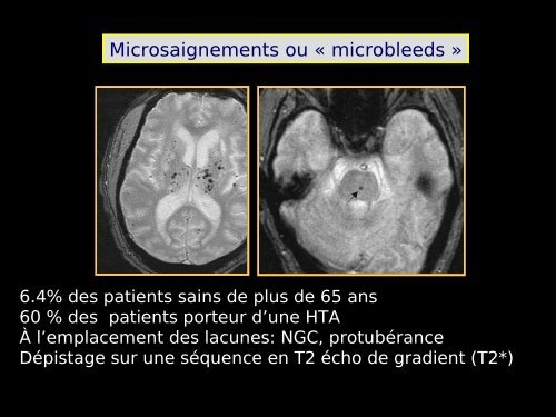 Imagerie cérébrale actuelle du sujet âgé (Dr. RODRIGO)