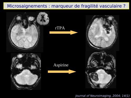 Imagerie cérébrale actuelle du sujet âgé (Dr. RODRIGO)