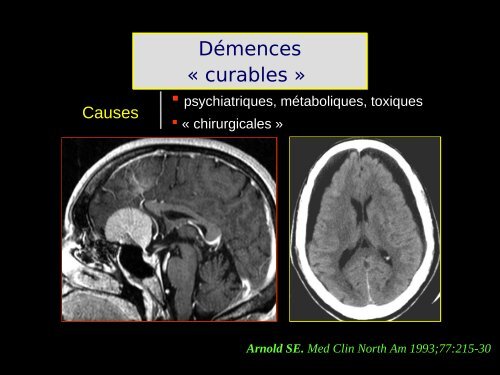 Imagerie cérébrale actuelle du sujet âgé (Dr. RODRIGO)