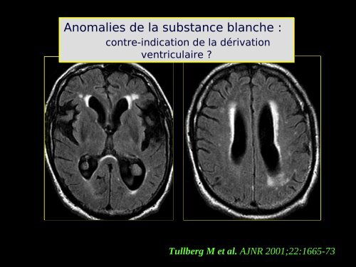 Imagerie cérébrale actuelle du sujet âgé (Dr. RODRIGO)