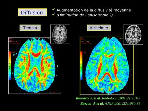 Imagerie cérébrale actuelle du sujet âgé (Dr. RODRIGO)