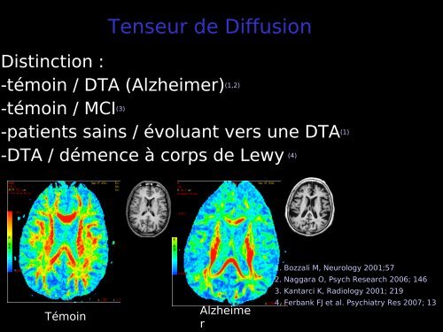 Imagerie cérébrale actuelle du sujet âgé (Dr. RODRIGO)