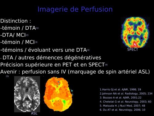 Imagerie cérébrale actuelle du sujet âgé (Dr. RODRIGO)