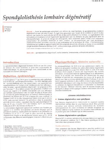 Spondylolisthésis lombaire dégénératif - L'Institut de la Colonne ...