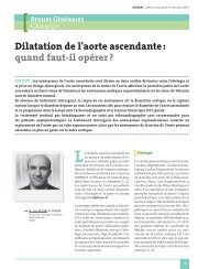 Dilatation de l'aorte ascendante - Réalités Cardiologiques