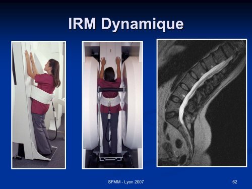 INSTABILITE VERTEBRALE TRAITEMENT ORTHOPEDIQUE ...