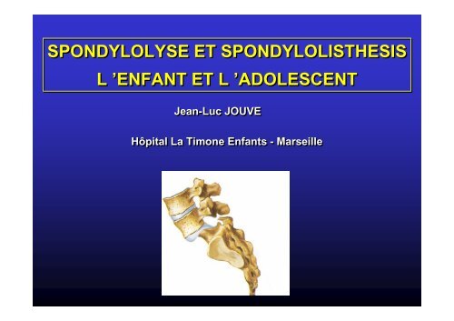 Spondylolisthésis - JL Jouve - SOFOP