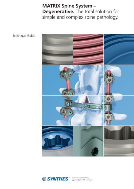 MATRIX Spine System – Degenerative. The total solution