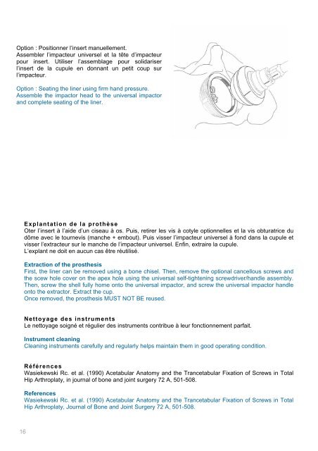 Brochure Ellistra français / english - Implants International