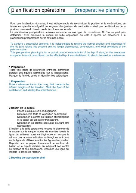 Brochure Ellistra français / english - Implants International