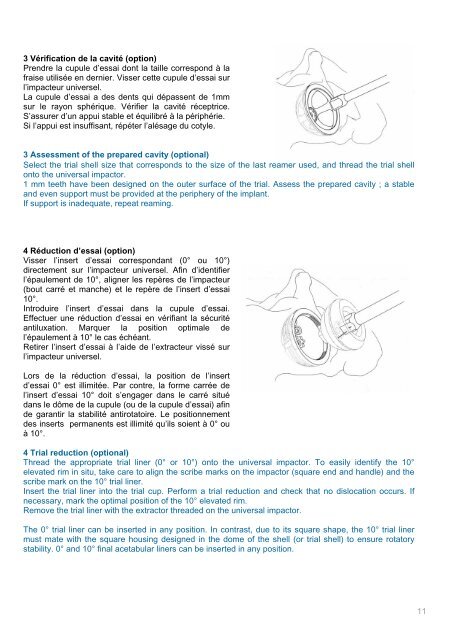 Brochure Ellistra français / english - Implants International